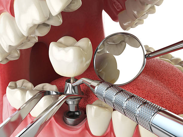 Best Broken or Cracked Tooth Emergency Dentist in Muleshoe, TX